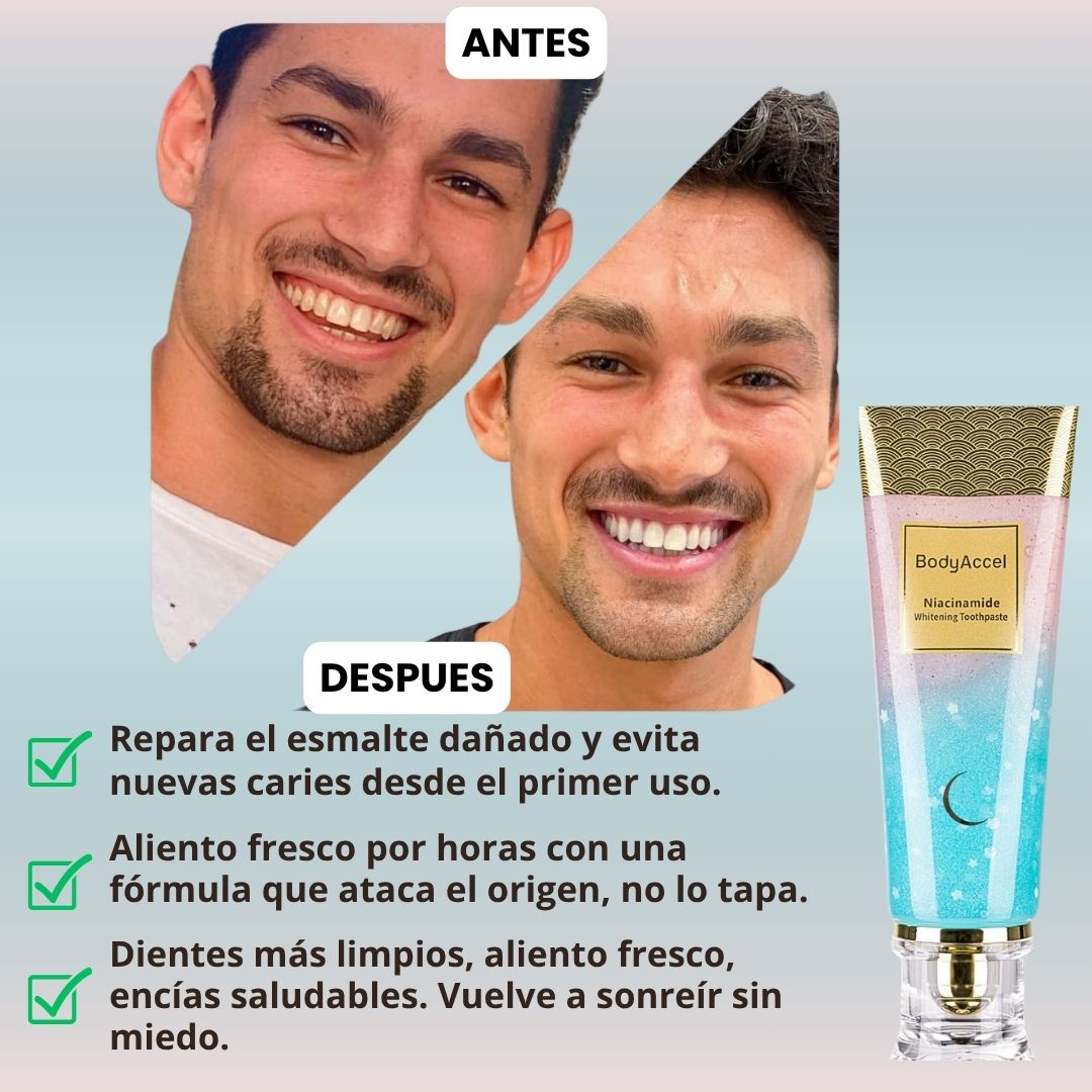 BodyAccel Con niacinamida – No ocultes tus dientes amarillos blanquealos
